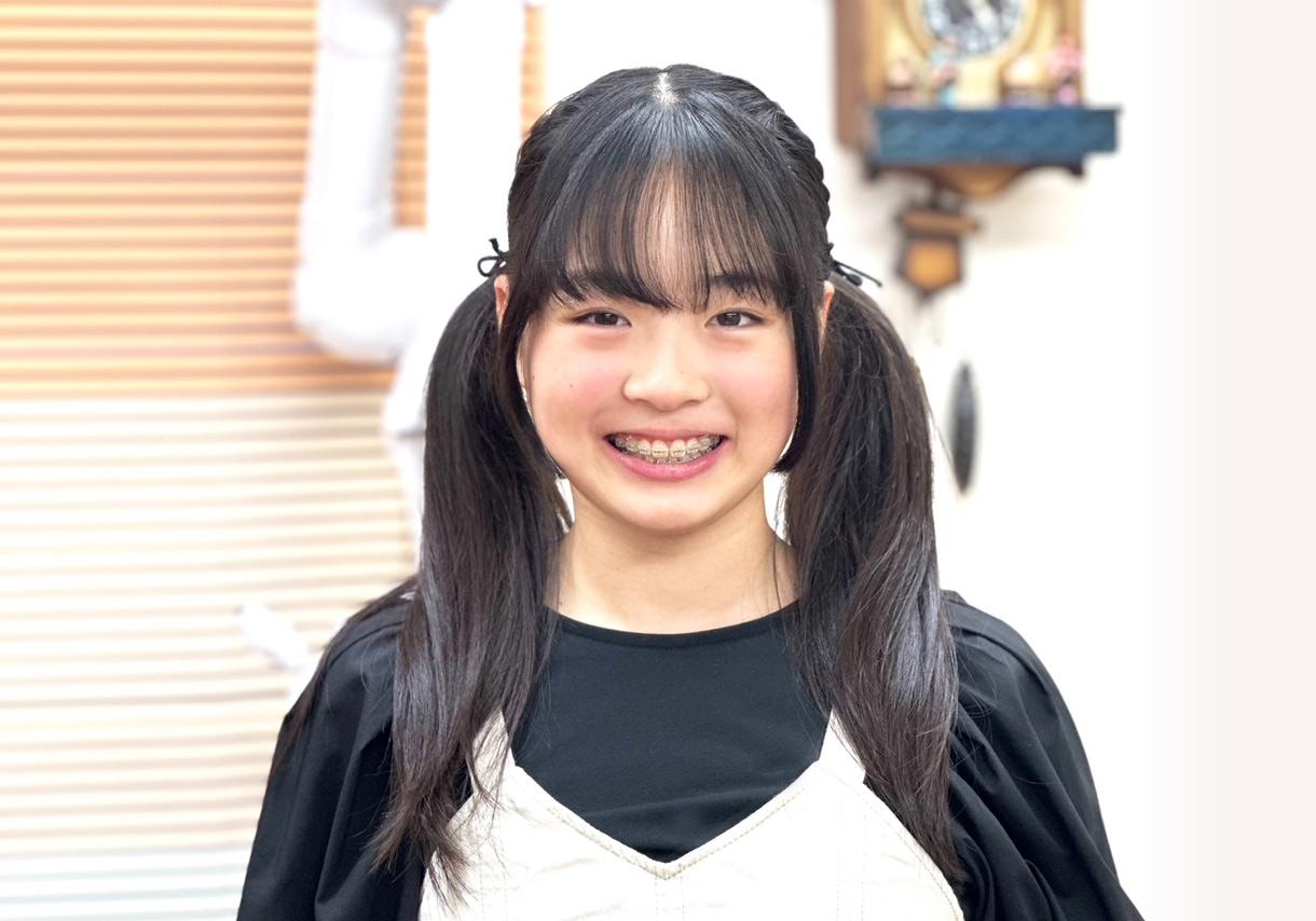 image:不正咬合の原因